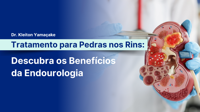 Equipe médica usando endoscópio em modelo de rim com cálculos renais em sala de cirurgia bem iluminada.